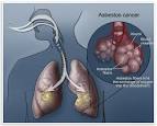 Asbestos and your lungs